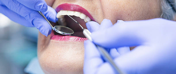 Best Emergency Dentist for Lost Fillings or Crowns in Casa Blanca, AZ